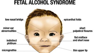 Alcohol & Pregnancy: Three Myths, Three Facts